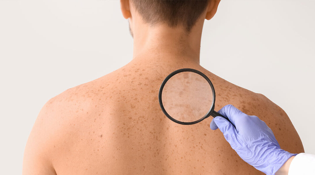 Frontiers in Dermatology
